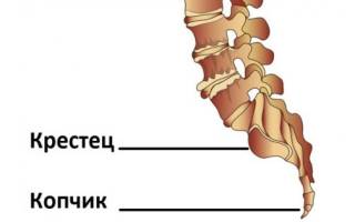 Резкая боль в копчике