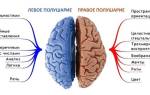 Ишемический инсульт головного мозга левая сторона