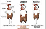 Симптомы гипоплазия щитовидной железы
