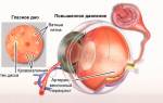 Чем опасно повышенное глазное давление