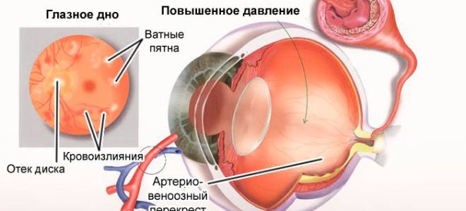 Глазное давление какое считается нормой