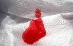 Алая кровь на туалетной бумаге после дефекации
