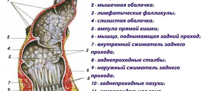 После туалета по большому болит попа