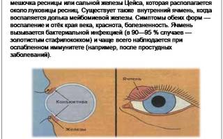 Чем вывести ячмень на глазу