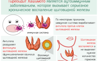 Питание при аит щитовидной железы