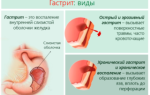 Тяжесть в правом и левом подреберье одновременно