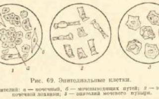 Норма плоского эпителия в моче у женщин