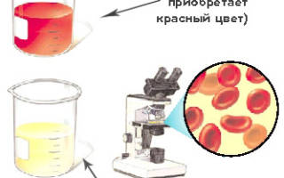 Пописал кровью мужчина