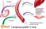 Режим питания при сахарном диабете 2 типа