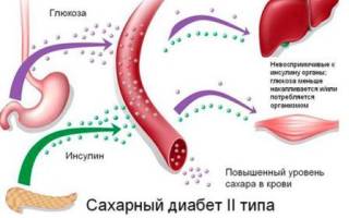 Режим питания при сахарном диабете 2 типа