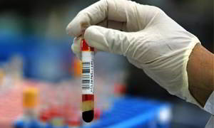 Клиническое исследование крови расшифровка